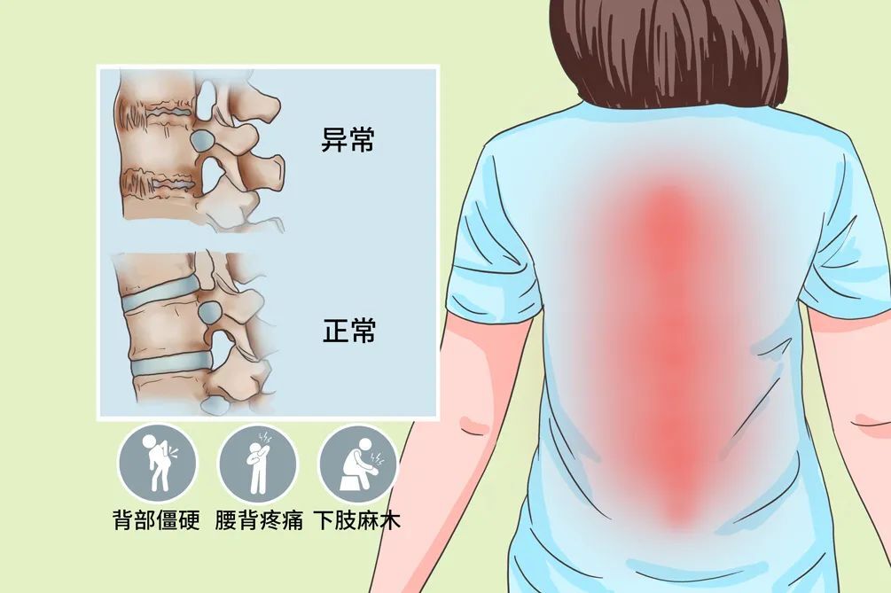 强直36.jpg